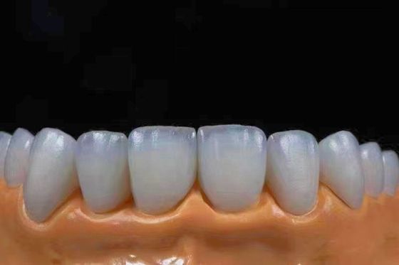 Mua Vương miện Zirconia thẩm mỹ rất trong suốt phù hợp với vẻ ngoài tự nhiên sản xuất trực tuyến