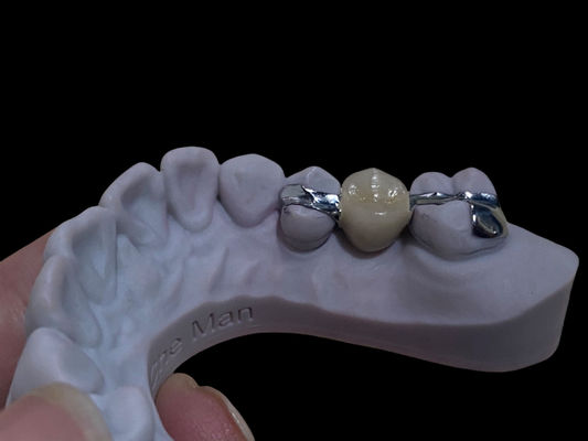 Mua Chọn chính xác màu trắng lâu dài Maryland cầu nha khoa tùy chỉnh để phục hồi sản xuất trực tuyến