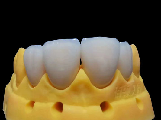 Mua Chống nước mắt Thiết kế đầy đủ Circonia Crown tùy chỉnh An toàn để sử dụng sản xuất trực tuyến