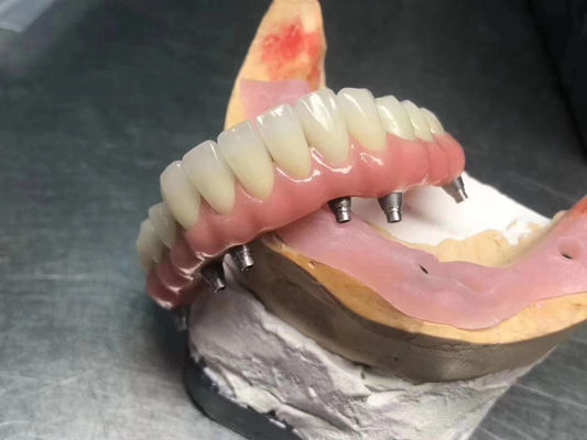 Mua Cao độ xuyên suốt cấy ghép vững chắc được hỗ trợ vương miện tùy chỉnh cho phục hồi răng sản xuất trực tuyến