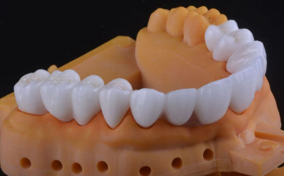 Tăng hoa răng Zirconia cao độ bền cực xuyên suốt với độ ổn định lâu dài