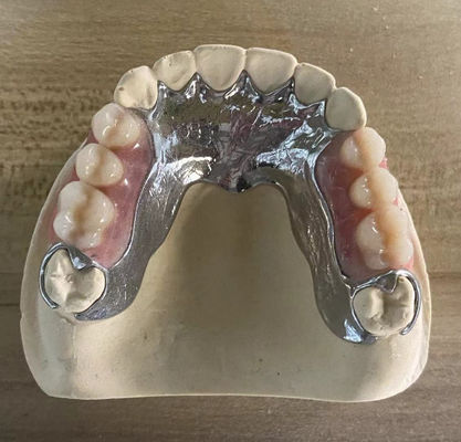 Chất liệu đúc cứng cao kim loại răng giả một phần Cocr Aolly với in 3D