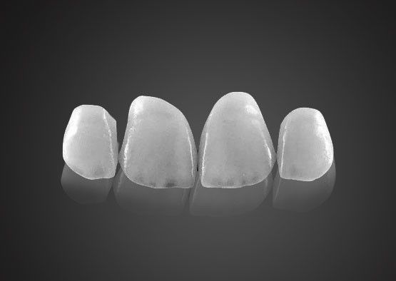 IPS 0.2mm Ultra Thin Emax Veneers chống vết bẩn với độ bền cao