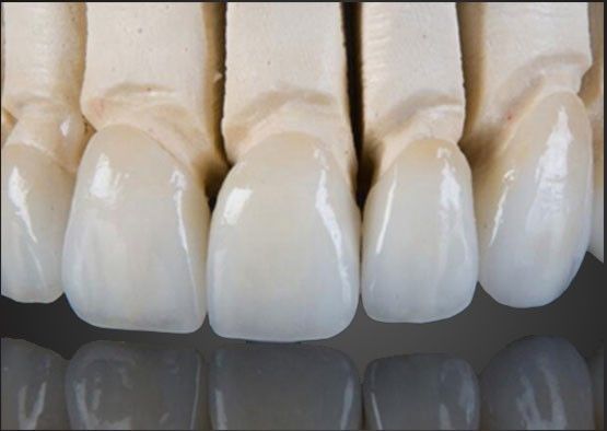 Wieland Zirconia Tất cả các vương miện gốm Sơn bên trong tùy chỉnh với thiết kế CAD
