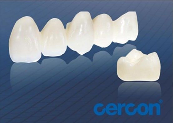 Chống mòn CAM Cercon Zirconia Vương miện Dễ lau chùi Tăng khả năng tương thích sinh học