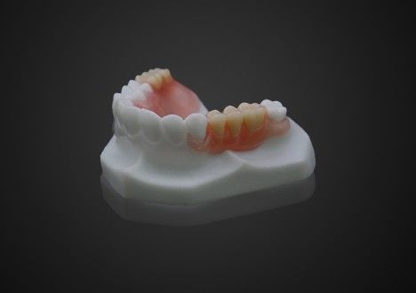 Đèn nhẹ thoải mái Valplast răng giả một phần dễ làm sạch minh bạch cao
