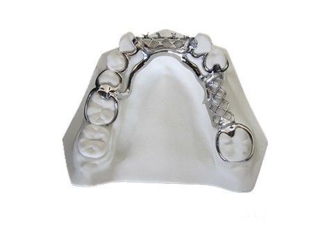 Anti Coloring Vitallium Denture một phần có thể tùy chỉnh cho lâu dài
