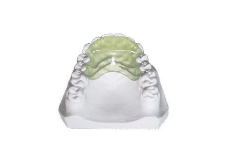 Thiết bị chức năng chỉnh nha có thể tháo rời