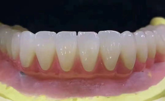 Tùy chỉnh nha khoa Zirconia răng vương miện chống vết bẩn với độ chính xác cao