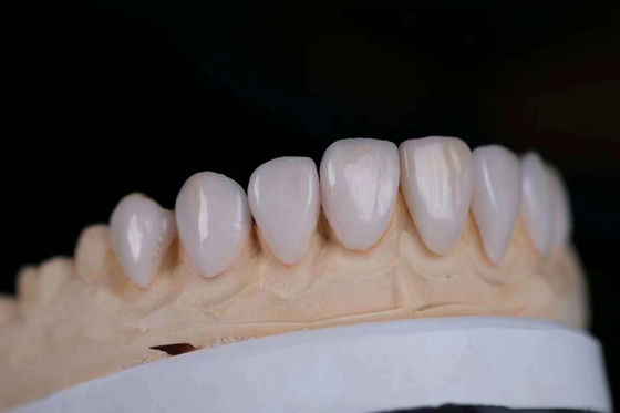 Long Lasting Multilayered Ceramic Zirconia Crown Điều chỉnh với FDA chứng nhận