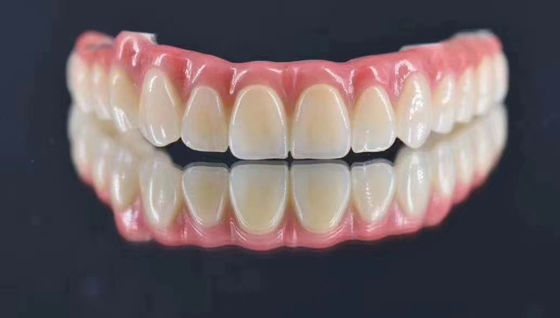 Phòng thí nghiệm nha khoa tùy chỉnh cấy ghép hỗ trợ vương miện kim loại tự nhiên tìm kiếm sự ổn định lâu dài