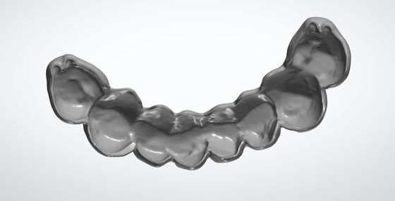Mỏ trứng xay CAD CAM Thiết kế nha khoa cho cấy ghép cầu tạm thời PMMA