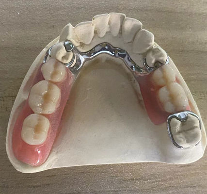 Phương pháp làm bằng kim loại bạc đáng tin cậy chống ăn mòn với thiết kế tùy chỉnh