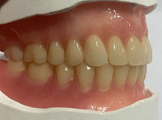 Đặt hàng tự nhiên nhìn đầy đủ răng giả răng Acrylic cho giữ tối ưu