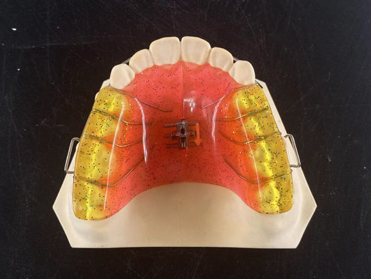 Tùy chỉnh 2 Ways Dental Arch Expander Thiết bị chỉnh sửa nha khoa