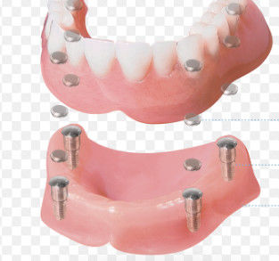 Đơn vị đính kèm từ tính cao độ chính xác răng bề mặt đánh bóng và tùy chỉnh