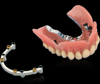 Vít thanh cấy ghép răng Titanium trơn được giữ lại với bề mặt bóng mượt