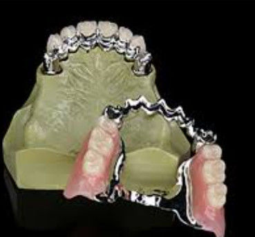 Sử dụng lâu dài tùy chỉnh khóa và khóa răng với sức mạnh cao