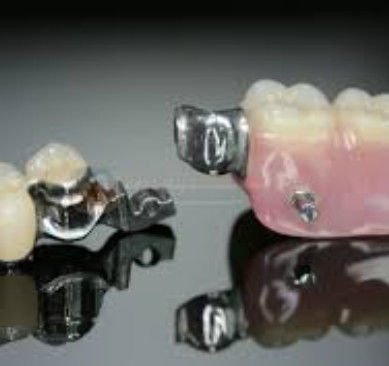 Độ linh hoạt cao Mk1 gắn răng chính xác cao và an toàn để sử dụng
