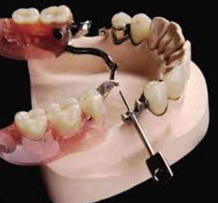 Đặt răng có thể điều chỉnh Mk1 chống nước bằng thép không gỉ